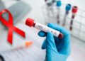 Diagnostician,holding,in,hand,a,positive,hiv,test.
