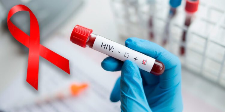 Diagnostician,holding,in,hand,a,positive,hiv,test.